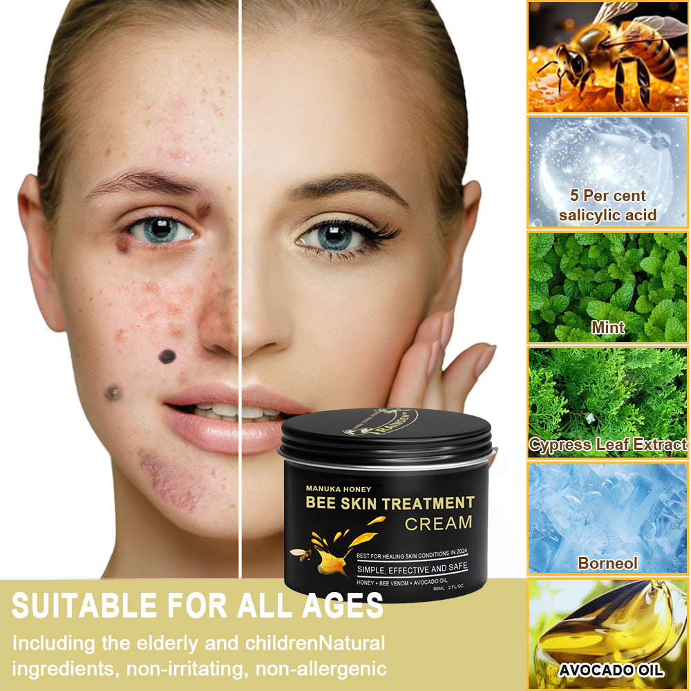 🏅👨‍⚕️Raindew™ Manuka Honey Bee Skin Treatment Cream🐝（AAD 𝑅𝑒𝑐𝑜𝑚𝑚𝑒𝑛𝑑𝑒𝑑） (🔥𝑳𝒂𝒔𝒕 𝒅𝒂𝒚 𝒑𝒓𝒐𝒎𝒐𝒕𝒊𝒐𝒏 7𝟎% 𝒐𝒇𝒇)