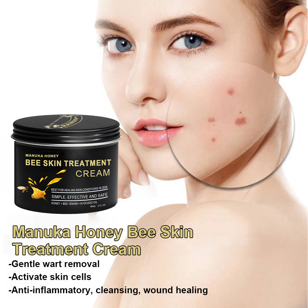 🏅👨‍⚕️Raindew™ Manuka Honey Bee Skin Treatment Cream🐝（AAD 𝑅𝑒𝑐𝑜𝑚𝑚𝑒𝑛𝑑𝑒𝑑） (🔥𝑳𝒂𝒔𝒕 𝒅𝒂𝒚 𝒑𝒓𝒐𝒎𝒐𝒕𝒊𝒐𝒏 7𝟎% 𝒐𝒇𝒇)