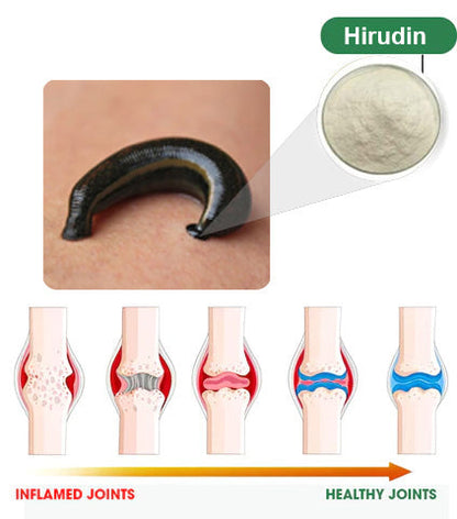 Raindew™ Leech Advanced Joint & Muscle Therapy Cream - specializing in orthopedic conditions